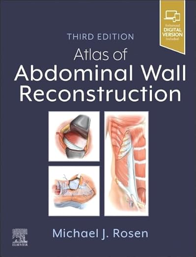 Atlas of Abdominal Wall Reconstruction 3rd Edition