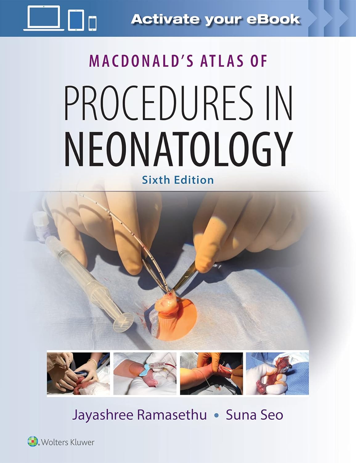 MacDonald's Atlas of Procedures in Neonatology 6th