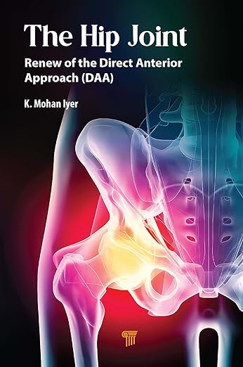 The Hip Joint: Renew of the Direct Anterior Approach (DAA) Kindle Edition