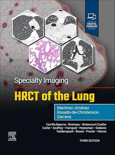 Specialty Imaging: HRCT of the Lung 3rd Edition