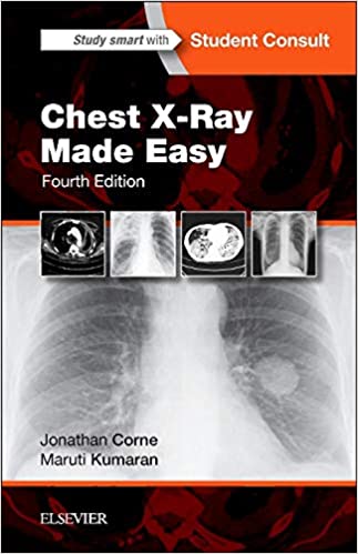 Chest X-Ray Made Easy (Fourth Edition)