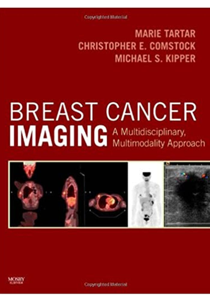 Breast Cancer Imaging: A Multidisciplinary, Multimodality Approach 1st Edition