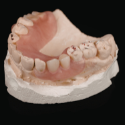 Prosthodontics