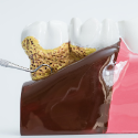 Periodontics