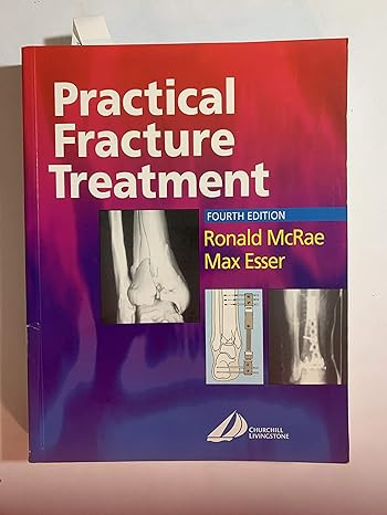 Practical Fracture Treatment, 4th Edition