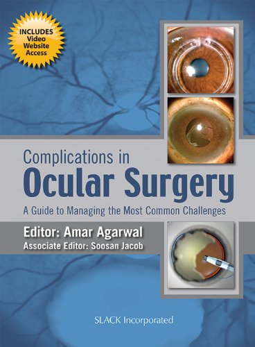 Complications in Cardiothoracic Surgery: Avoidance and Treatment 2nd Edition, Kindle Edition color