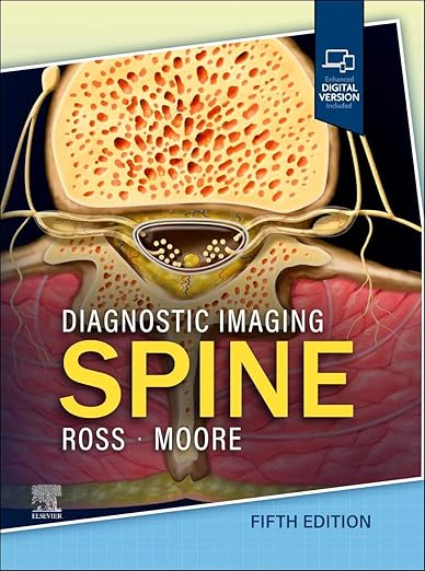 Diagnostic Imaging: Spine 5th Edition