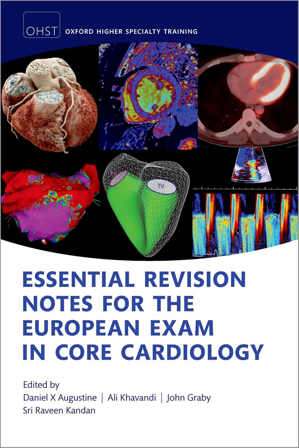 Essential Revision notes for the European Exam in Core Cardiology (Oxford Higher Specialty Training) 2nd Edition
