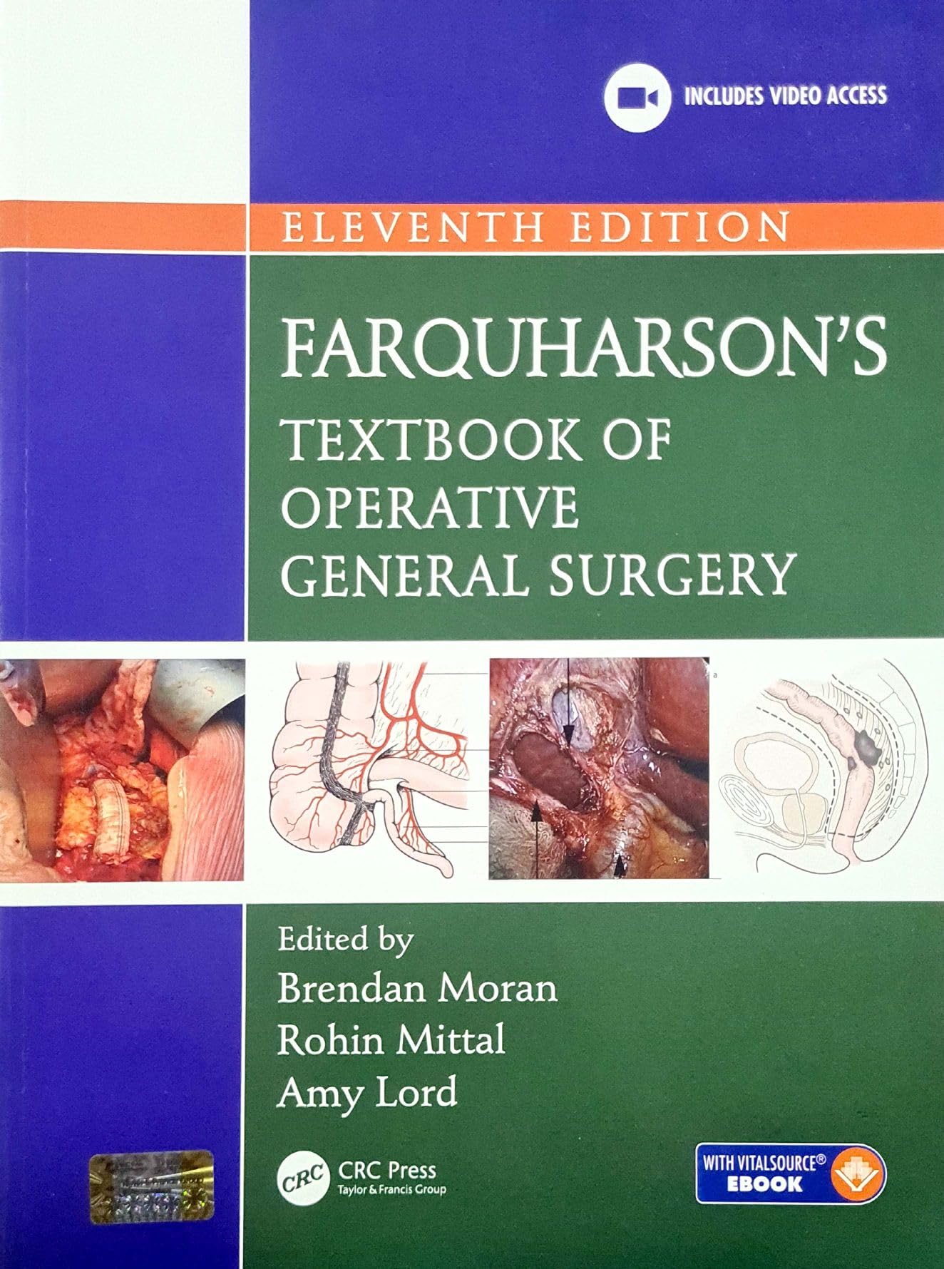 Farquharson’s Textbook of Operative General Surgery Eleventh Edition