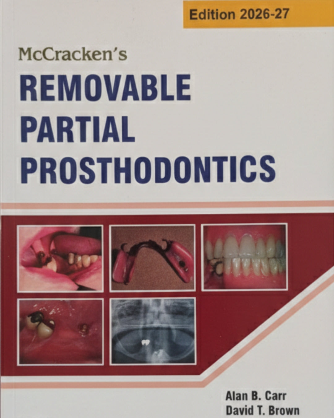 McCracken's Removable Partial Prosthodontics