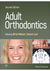 Adult Orthodontics 2nd Edition