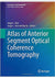 Atlas of Anterior Segment Optical Coherence Tomography