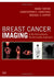 Breast Cancer Imaging: A Multidisciplinary, Multimodality Approach 1st Edition