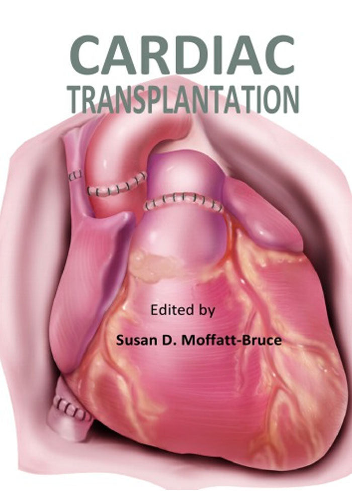 Cardiac Transplantation Classic Medical Books