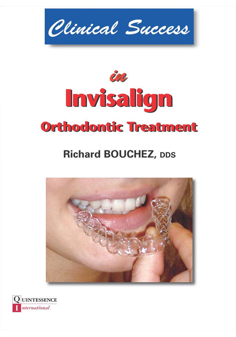 Clinical Success in Invisalign Orthodontic Treatment