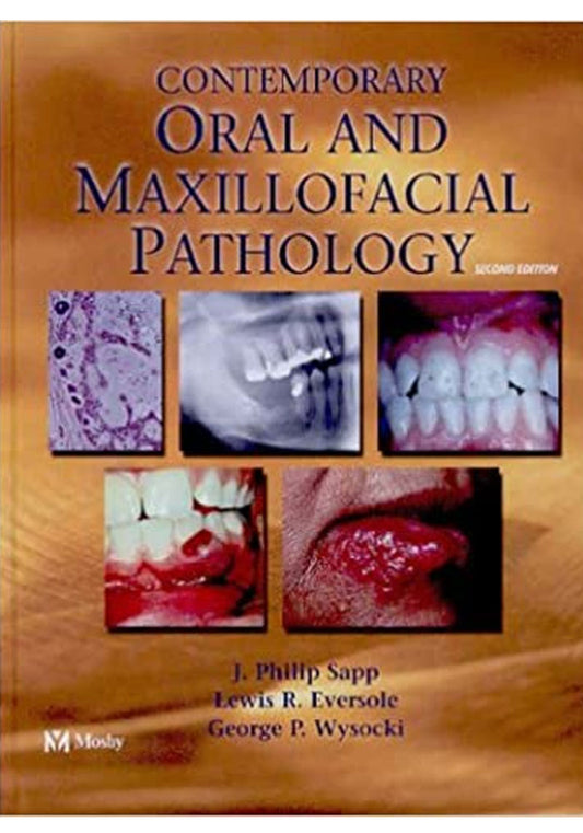 Contemporary Oral & Maxillofacial Pathology 2nd EDITION Unknown Binding