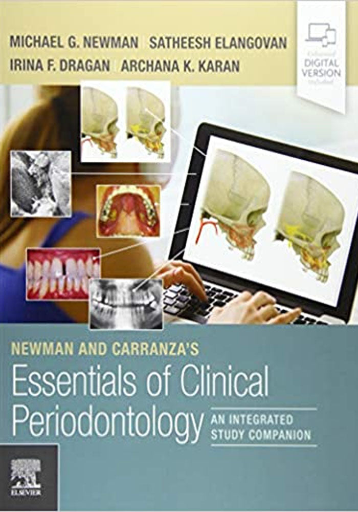 Newman and Carranza's Essentials of Clinical Periodontology