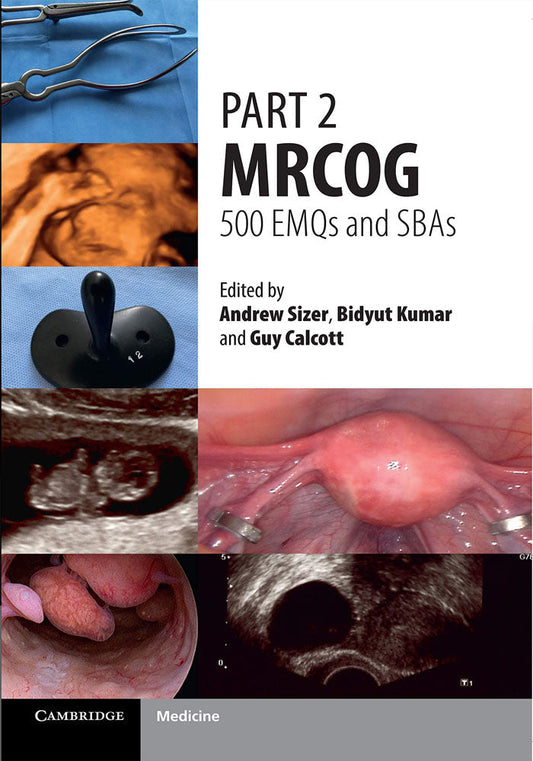 Part 2 MRCOG: 500 EMQs and SBAs