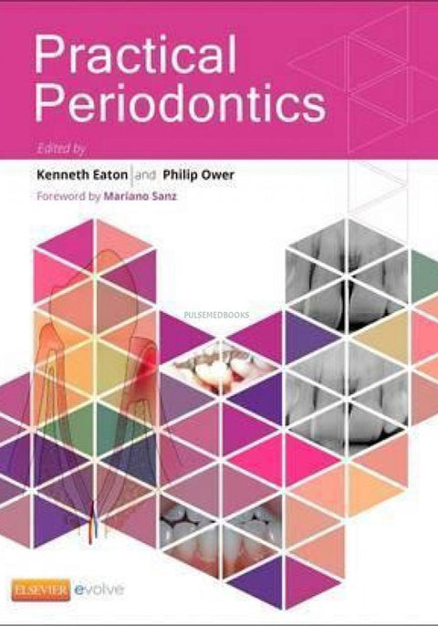 Practical Periodontics