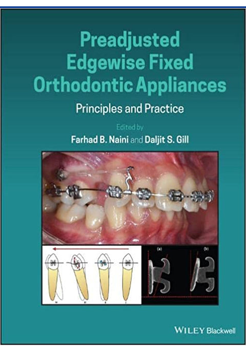 Preadjusted Edgewise Fixed Orthodontic Appliances Principles and Practice