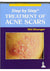 Step by Step Treatment of Acne Scars