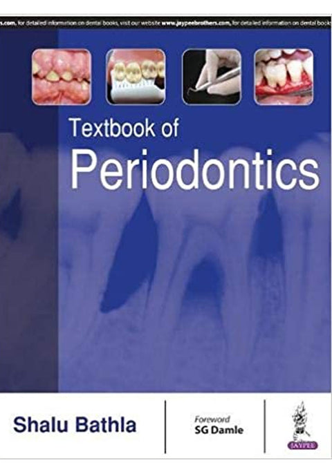 Textbook of Periodontics 1st Edition