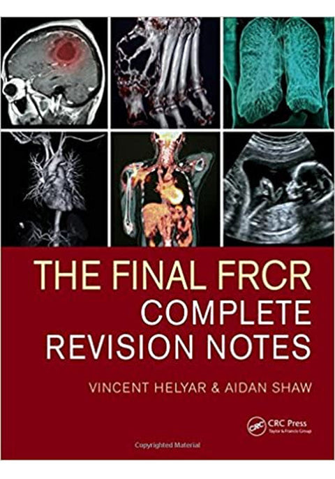 The Final FRCR: Complete Revisio