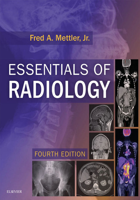 Essential of Radiology